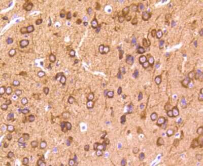 Immunohistochemistry-Paraffin: Tau [p Thr231] Antibody (SC58-08) [NBP2-67574] - Analysis of paraffin-embedded mouse brain tissue using anti- phospho -Tau(T231) antibody. Counter stained with hematoxylin.