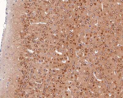 Immunohistochemistry-Paraffin: Tau [p Thr231] Antibody (SC58-08) [NBP2-67574] - Analysis of paraffin-embedded mouse brain tissue with Rabbit anti-Tau [p Thr231] antibody washed with ddH2O and PBS, and then probed with the primary antibody  at 1/200 dilution for 1 hour at room temperature. The detection was performed using an HRP conjugated compact polymer system. DAB was used as the chromogen. Tissues were counterstained with hematoxylin and mounted with DPX.