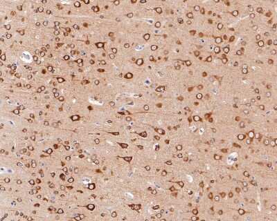 Immunohistochemistry-Paraffin: Tau [p Thr231] Antibody (SC58-08) [NBP2-67574] - Analysis of paraffin-embedded rat brain tissue with Rabbit anti-Tau [p Thr231] antibody washed with ddH2O and PBS, and then probed with the primary antibody  at 1/800 dilution for 1 hour at room temperature. The detection was performed using an HRP conjugated compact polymer system. DAB was used as the chromogen. Tissues were counterstained with hematoxylin and mounted with DPX.