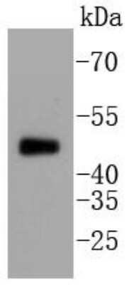 Western Blot: Tau [p Thr231] Antibody (SC58-08) [NBP2-67574] - Analysis of phospho -Tau(T231) on mouse brain lysates using anti-Tau(phospho T231) antibody at 1/1,000 dilution.