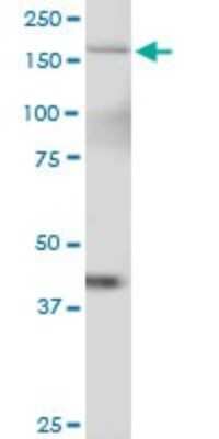 Western Blot: Tau tubulin kinase 2 Antibody [H00146057-B01P] - Analysis of TTBK2 expression in K-562.