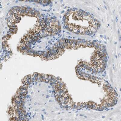 Immunohistochemistry-Paraffin: TauT/SLC6A6 Antibody [NBP1-86964] - Staining of human Prostate shows moderate membranous positivity in glandular cells.