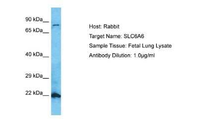 Western Blot: TauT/SLC6A6 Antibody [NBP2-85875] - Host: Rabbit. Target Name: SC6A6. Sample Type: Fetal Lung lysates. Antibody Dilution: 1.0ug/ml