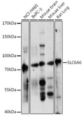 Western Blot: TauT/SLC6A6 Antibody [NBP2-93858] - Western blot analysis of extracts of various cell lines, using TauT/SLC6A6 at 1:1000 dilution. Secondary antibody: HRP Goat Anti-Rabbit IgG (H+L) at 1:10000 dilution.Lysates/proteins: 25ug per lane. Blocking buffer: 3% nonfat dry milk in TBST. Detection: ECL Basic Kit. Exposure time: 10s.