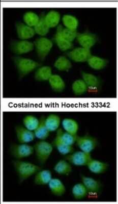 Immunocytochemistry/Immunofluorescence: Tbp7 Antibody [NBP2-20581] - Immunofluorescence analysis of paraformaldehyde-fixed A431, using antibody at 1:200 dilution.