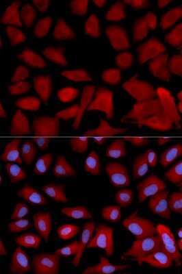 Immunocytochemistry/Immunofluorescence: Tbp7 Antibody [NBP2-93919] - Analysis of U2OS cells using Tbp7 . Blue: DAPI for nuclear staining.