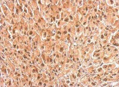 Immunohistochemistry-Paraffin: Tbp7 Antibody [NBP2-20581] -  Paraffin-embedded Mahlarvu xenograft.  PSMC4 antibody dilution: 1:500.