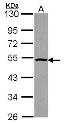 Western Blot: Tbp7 Antibody [NBP2-20581] - Sample (30 ug of whole cell lysate) A: JurKat 10% SDS PAGE gel, diluted at 1:1000.