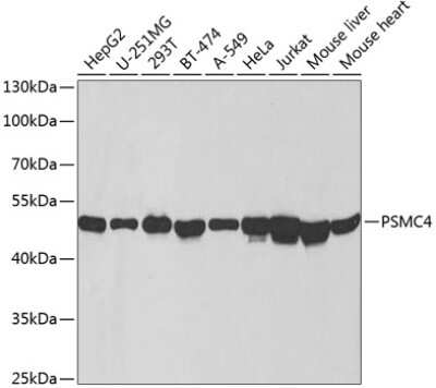 Western Blot: Tbp7 Antibody [NBP2-93919] - Analysis of extracts of various cell lines, using Tbp7 at 1:1000 dilution. Secondary antibody: HRP Goat Anti-Rabbit IgG (H+L) at 1:10000 dilution. Lysates/proteins: 25ug per lane. Blocking buffer: 3% nonfat dry milk in TBST. Detection: ECL Basic Kit . Exposure time: 30s.