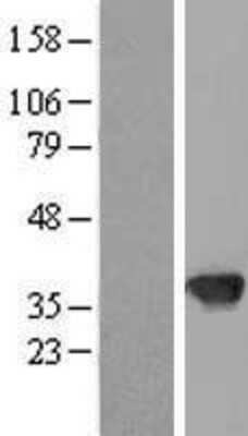 Western Blot: Tbx20 Overexpression Lysate (Adult Normal) [NBP2-10191] Left-Empty vector transfected control cell lysate (HEK293 cell lysate); Right -Over-expression Lysate for Tbx20.