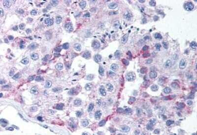 Immunohistochemistry-Paraffin: Tbx6 Antibody [NBP1-02529] - Staining of human testis. Immunohistochemistry of formalin-fixed, paraffin-embedded tissue after heat-induced antigen retrieval. Antibody concentration 10 ug/ml.