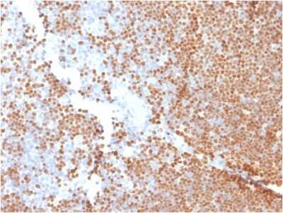 Immunohistochemistry-Paraffin: TdT Antibody (DNTT/1453) - Azide and BSA Free [NBP3-08563] - Formalin-fixed, paraffin-embedded human Thymus stained with TdT Mouse Monoclonal Antibody (DNTT/1453).