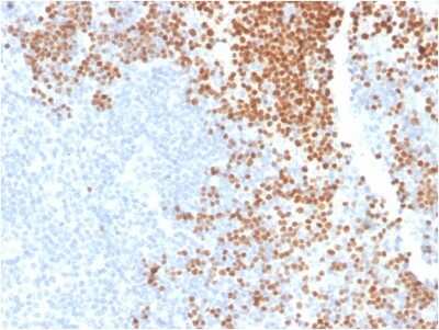 Immunohistochemistry-Paraffin: TdT Antibody (DNTT/1453) - Azide and BSA Free [NBP3-08563] - Formalin-fixed, paraffin-embedded human Thymus stained with TdT Mouse Monoclonal Antibody (DNTT/1453).