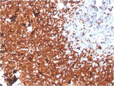 Immunohistochemistry-Paraffin: TdT Antibody (DNTT/1453) - Azide and BSA Free [NBP3-08563] - Formalin-fixed, paraffin-embedded human Thymus stained with TdT Mouse Monoclonal Antibody (DNTT/1453).