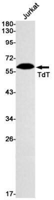 Western Blot: TdT Antibody (S01-1C3) [NBP3-19930] - Western blot detection of TdT in Jurkat cell lysates using TdT Rabbit mAb (1:1000 diluted). Predicted band size: 59kDa. Observed band size: 59kDa.