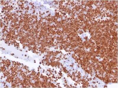 Immunohistochemistry-Paraffin: TdT Antibody (TDT/1393) - Azide and BSA Free [NBP3-08484] - Formalin-fixed, paraffin-embedded human thymus stained with TdT Antibody (TDT/1393).