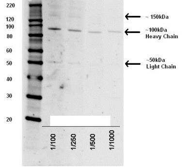 Western Blot: Tetanus Toxin Antibody [NB100-63239] - 1 ug of tetanus toxin (Sigma T3194-25UG) per well.