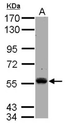 Western Blot: Tec Antibody [NBP2-20591] - Sample (30 ug of whole cell lysate) A: A549 7. 5% SDS PAGE gel, diluted at 1:1000.