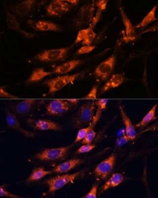 Immunocytochemistry/Immunofluorescence: Teneurin-1 Antibody [NBP2-93336] - Analysis of C6 cells using Teneurin-1 at dilution of 1:100. Blue: DAPI for nuclear staining.