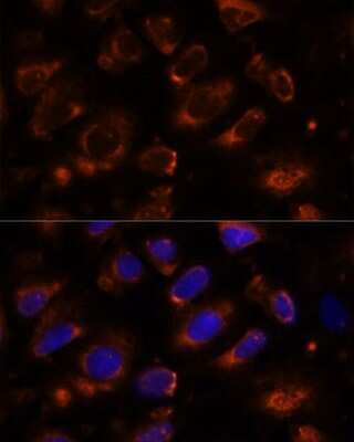 Immunocytochemistry/Immunofluorescence: Teneurin-1 Antibody [NBP2-93336] - Analysis of U-2 OS cells using Teneurin-1 at dilution of 1:100. Blue: DAPI for nuclear staining.