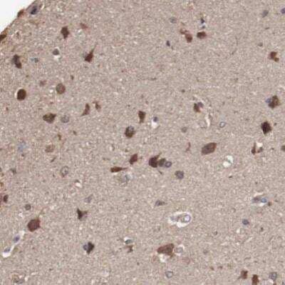 Immunohistochemistry-Paraffin: Teneurin-1 Antibody [NBP2-52739] - Staining of human cerebral cortex shows strong cytoplasmic positivity in neuronal cells.