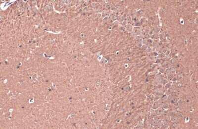 Immunohistochemistry-Paraffin: Teneurin-1 Antibody [NBP3-13409] - Teneurin-1 antibody detects Teneurin-1 protein at cell membrane and cytoplasm by immunohistochemical analysis. Sample: Paraffin-embedded mouse hippocampus. Teneurin-1 stained by Teneurin-1 antibody (NBP3-13409) diluted at 1:200. Antigen Retrieval: Citrate buffer, pH 6.0, 15 min