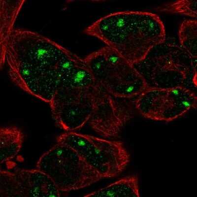Immunocytochemistry/Immunofluorescence: Teneurin-2 Antibody [NBP2-55763] - Staining of human cell line RH-30 shows localization to nucleoli.