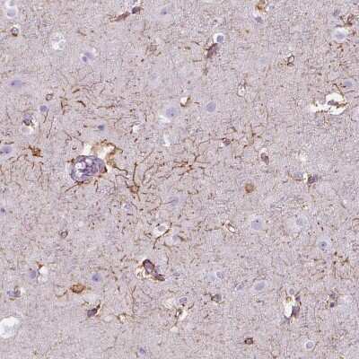 Immunohistochemistry-Paraffin: Teneurin-4 Antibody [NBP2-57382] - Staining of human cerebral cortex shows moderate cytoplasmic positivity in glial cells.