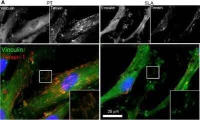 Immunocytochemistry/Immunofluorescence: Tensin 1 Antibody [NBP1-84129] - Adhesions are more mature and stable on PT compared to SLA. Co-localizations of tensin-1 and p-cortactin with vinculin were shown by immunocytochemical staining of HGFs cultured on PT and SLA surfaces at 24 hrs. Cells were labelled for integrin tensin-1 (red), vinculin (green), and nuclei (blue). Representative images of HGFs on PT and SLA observed under fluorescence microscopy. Grey scale images are shown for separate channels for tensin-1, and vinculin. Inserts show higher magnifications of focal contacts (white boxes). Image collected and cropped by CiteAb from the following publication (//doi.wiley.com/10.1111/jcmm.12451), licensed under a CC-BY license.