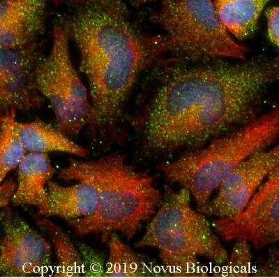 Immunocytochemistry/Immunofluorescence: Tensin 1 Antibody [NBP2-78783] - HeLa cells were fixed for 10 minutes using 10% formalin and then permeabilized for 5 minutes using 1X PBS + 0.05% Triton-X100. The cells were incubated with anti-Tensin1 at 2 ug/ml overnight at 4C and detected with an anti-rabbit Dylight 488 (Green) at a 1:500 dilution. Alpha tubulin (DM1A) NB100-690 was used as a co-stain at a 1:1000 dilution and detected with an anti-mouse Dylight 550 (Red) at a 1:500 dilution. Nuclei were counterstained with DAPI (Blue). Cells were imaged using a 40X objective.