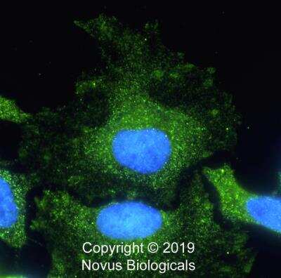 Immunocytochemistry/Immunofluorescence: Tensin 1 Antibody [NBP2-78783] - HeLa cells were fixed in 4% paraformaldehyde for 10 min and permeabilized in 0.05% Triton X-100 for 5 minutes. The cells were incubated with anti-Tensin 1 at 2 ug/ml for 60 minutes at room temperature and detected with an anti-rabbit Dylight 488 (Green) at a 1:1000 dilution for 60 minutes. Nuclei were counterstained with DAPI (Blue).  Cells were imaged using a 100X objective and digitally deconvolved.  Note the localization of Tensin1 to focal adhesion sites.