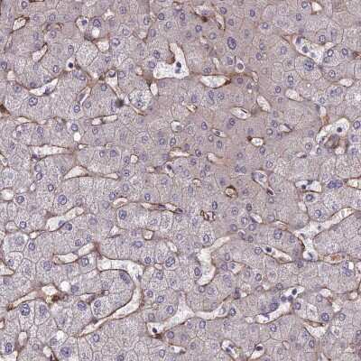 Immunohistochemistry-Paraffin: Tensin 1 Antibody [NBP1-84129] - Staining of human liver shows moderate membranous positivity in hepatocytes.