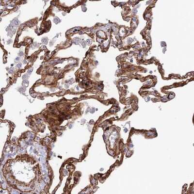 Immunohistochemistry-Paraffin: Tensin 1 Antibody [NBP1-84129] - Staining of human lung shows moderate positivity.