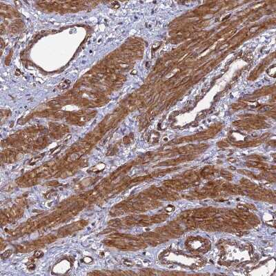 Immunohistochemistry-Paraffin: Tensin 1 Antibody [NBP1-84129] - Staining of human smooth muscle shows moderate cytoplasmic positivity in myocytes.