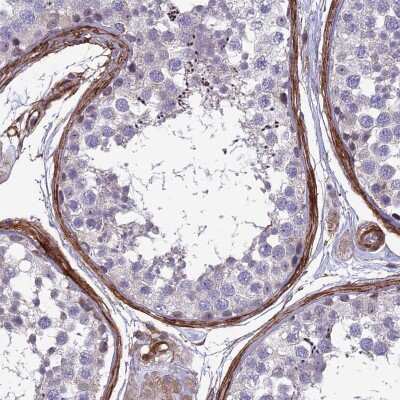 Immunohistochemistry-Paraffin: Tensin 1 Antibody [NBP1-84129] - Staining of human testis shows moderate membranous positivity.