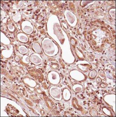 Immunohistochemistry-Paraffin: Tensin 1 Antibody [NBP2-78783] - Analysis of a FFPE tissue section of the human kidney using 1:200 dilution of Tensin1 antibody (NBP2-78783). The signal was developed using HRP-DAB method which followed counterstaining of the cells with hematoxylin. The antibody generated mainly strong cytoplasmic staining in all cells in glomeruli and tubules.