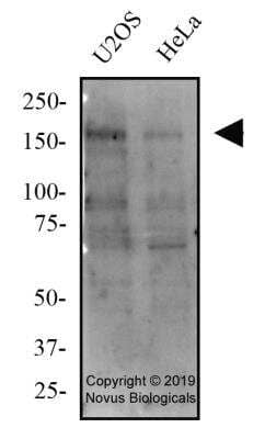 Western Blot: Tensin 1 Antibody [NBP2-78783] - Total protein from human U2OS and HeLa cell lines was separated on a 7.5% gel by SDS-PAGE, transferred to PVDF membrane and blocked in 5% non-fat milk in TBST. The membrane was probed with 2.0 ug/ml anti-Tensin1 in block buffer and detected with an anti-rabbit HRP secondary antibody using West Pico PLUS chemiluminescence detection reagent.