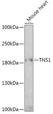 Western Blot: Tensin 1 Antibody [NBP2-94228] - Analysis of extracts of Mouse heart, using Tensin 1 at 1:1000 dilution.Secondary antibody: HRP Goat Anti-Rabbit IgG (H+L) at 1:10000 dilution.Lysates/proteins: 25ug per lane.Blocking buffer: 3% nonfat dry milk in TBST.Detection: ECL Basic Kit .Exposure time: 90s.