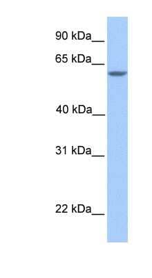 Western Blot: Tesmin Antibody [NBP1-59090] - Human Brain lysate, concentration 0.2-1 ug/ml.