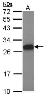 Western Blot: Tesmin Antibody [NBP2-20600] - Sample (30 ug of whole cell lysate) A: NT2D1 12% SDS PAGE gel, diluted at 1:1000.
