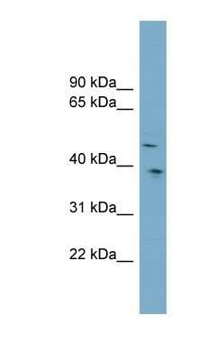 Western Blot: Testican 3/SPOCK3 Antibody [NBP1-59703] - OVCAR-3 cell lysate, concentration 0.2-1 ug/ml.