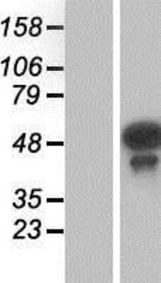 Western Blot Testin Overexpression Lysate