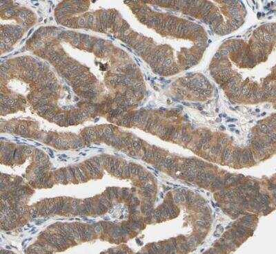 Immunohistochemistry-Paraffin: Testis Development Related Protein Antibody [NBP1-93675] - Staining of human fallopian tube shows moderate cytoplasmic positivity in glandular cells.