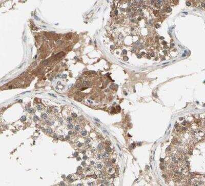 Immunohistochemistry-Paraffin: Testis Development Related Protein Antibody [NBP1-93675] - Staining of human testis shows moderate cytoplasmic positivity in Leydig cells.