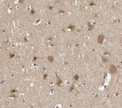Immunohistochemistry-Paraffin: Testis Development Related Protein Antibody [NBP1-93675] - Staining of human cerebral cortex shows weak cytoplasmic positicity in neurons.