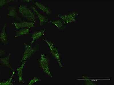 Immunocytochemistry/Immunofluorescence: Testis expressed 264 Antibody [H00051368-D01P] - Analysis of antibody to TEX264 on HeLa cell. Antibody concentration 10 ug/ml.