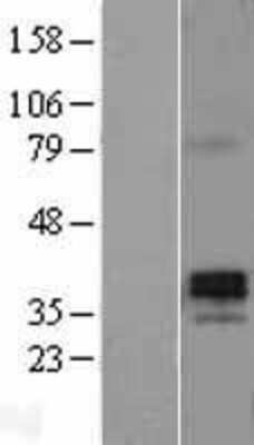 Western Blot: Testisin Overexpression Lysate (Adult Normal) [NBL1-14843] Left-Empty vector transfected control cell lysate (HEK293 cell lysate); Right -Over-expression Lysate for Testisin.