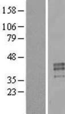 Western Blot: Testisin Overexpression Lysate (Adult Normal) [NBL1-14844] Left-Empty vector transfected control cell lysate (HEK293 cell lysate); Right -Over-expression Lysate for Testisin.