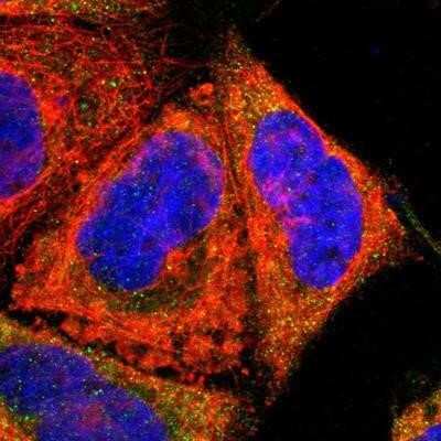 Immunocytochemistry/Immunofluorescence: Testisin/Prss21 Antibody [NBP1-84789] - Staining of human cell line A-431 shows positivity in cytoplasm. Antibody staining is shown in green.