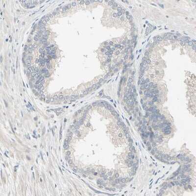 Immunohistochemistry-Paraffin: Testisin/Prss21 Antibody [NBP1-84789] - Staining of human prostate shows no membranous positivity in glandular cells as expected.